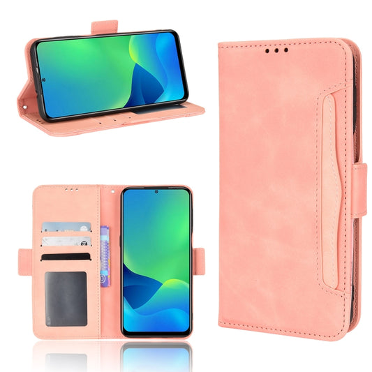 For Ulefone Note 13P Skin Feel Calf Pattern Leather Phone Case(Pink) - Ulefone Cases by buy2fix | Online Shopping UK | buy2fix