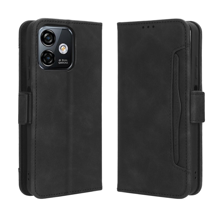 For Ulefone Note 16 Pro Skin Feel Calf Texture Card Slots Leather Phone Case(Black) - Ulefone Cases by buy2fix | Online Shopping UK | buy2fix